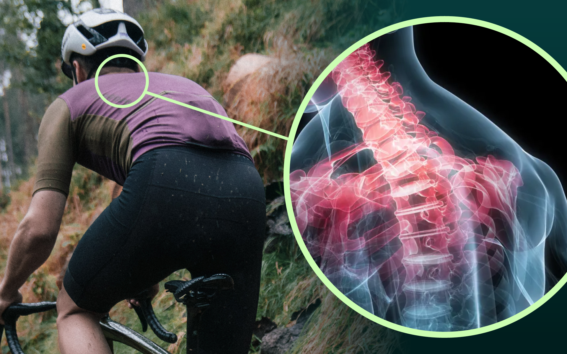 Posedla Academy | Chronic back and neck pain in cycling